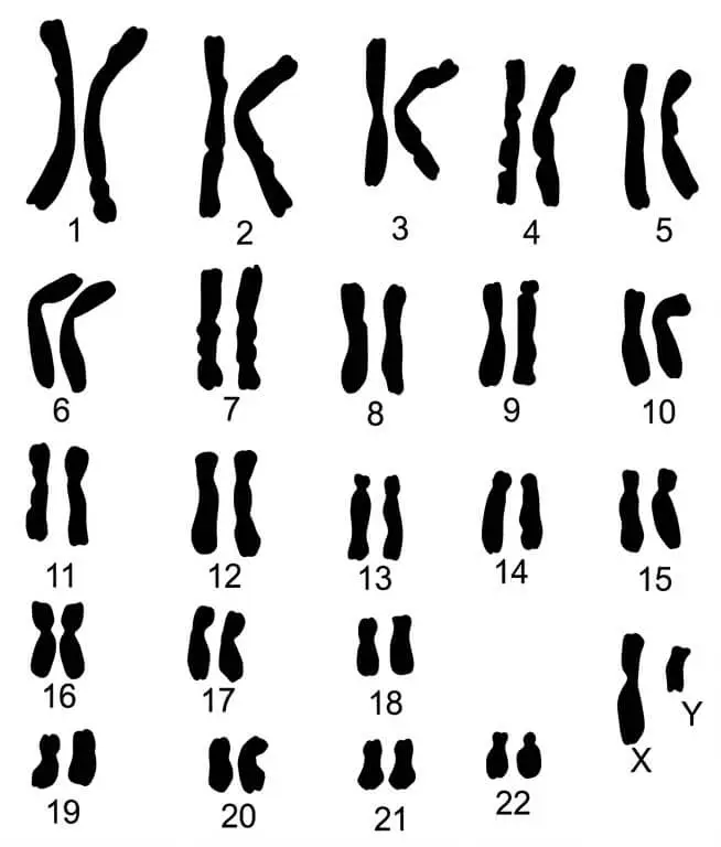 Caryotype humain d'un individu de sexe masculin montrant 22 paires d'autosomes et une paire de chromosomes sexuels XY. Les chromosomes sont classés par taille et par forme.