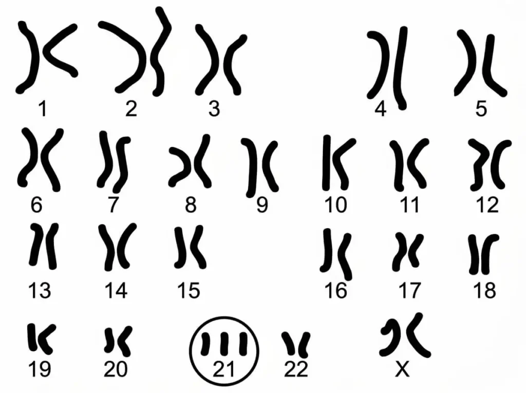 Caryotype humain montrant une trisomie 21 (syndrome de Down) avec trois chromosomes sur la paire 21.
