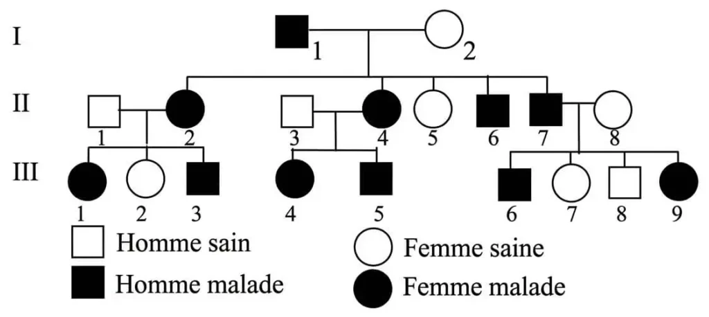 Arbre généalogique (pedigree) de la transmission de la neurofibromatose de type 1 sur trois générations.
